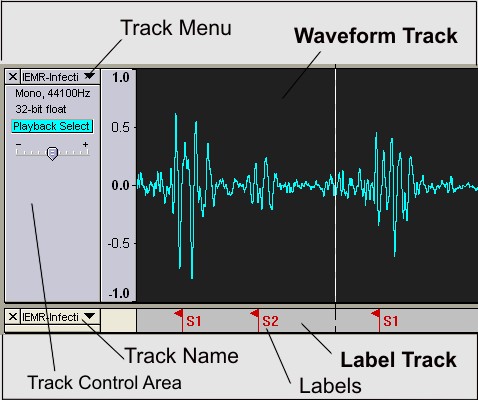 track waveform